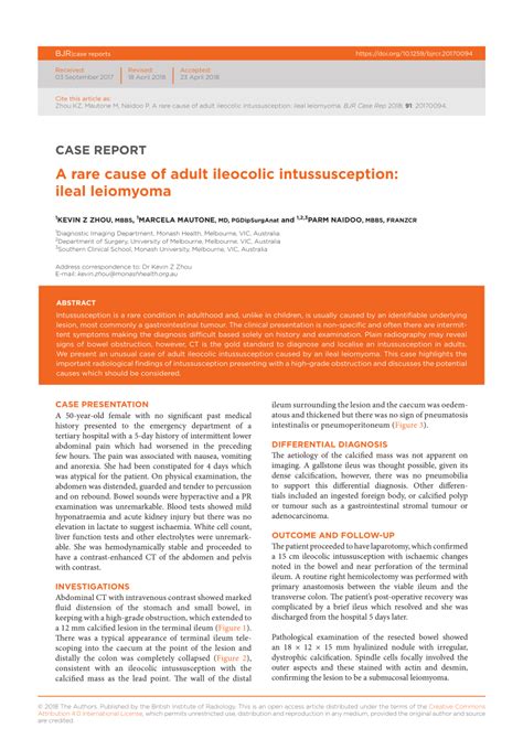 Pdf A Rare Cause Of Adult Ileocolic Intussusception Ileal Leiomyoma