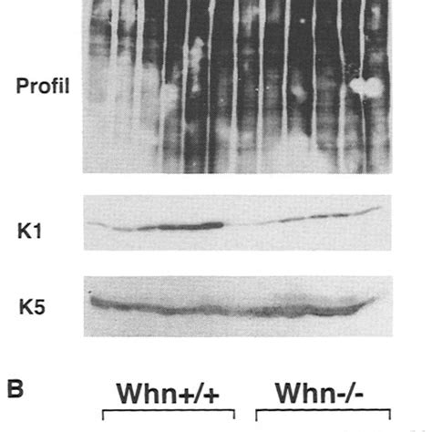 Aberrant Differentiation Marker Expression In Nude Mouse Keratinocytes