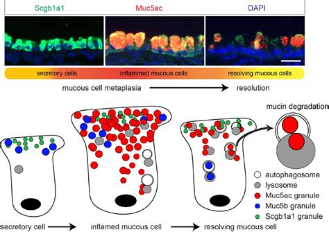 Mucin Granules Are Degraded In The Autophagosome Lysosome Pathway As A