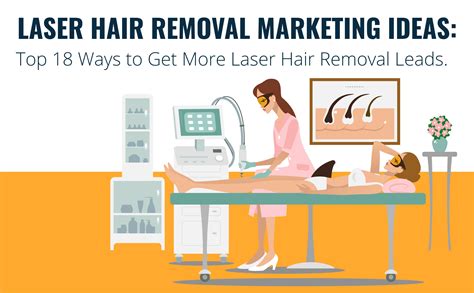 Marketing Ideas For Laser Hair Removal Factory Sale