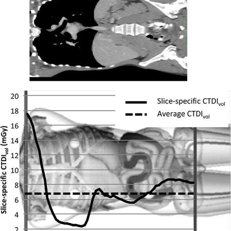 Pdf Ncict A Computational Solution To Estimate Organ Doses For