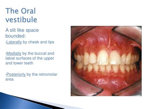 Vestibule Oral Cavity Anatomy