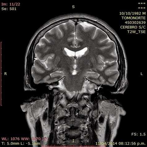 Radiologia Rmc Koda Abril