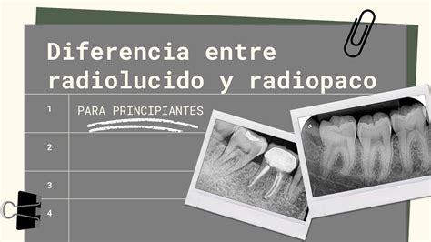 Radiopacidad Conoce La Diferencia Entre Radiopaco Y Radiol Cido Neurat