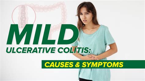 Mild Ulcerative Colitis Causes And Symptoms Highcarbhealth