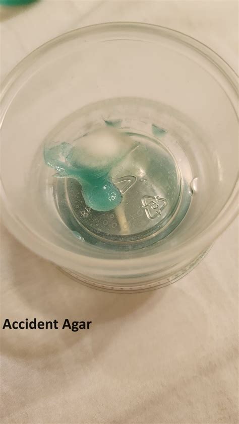 Help With Agar Accident Mushroom Cultivation Shroomery Message Board