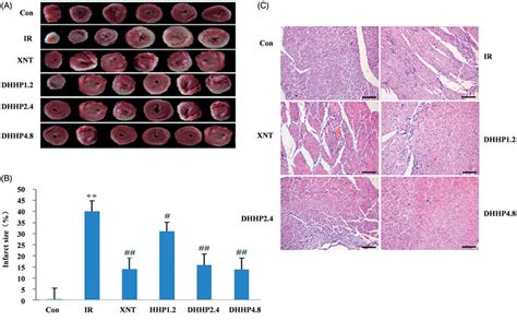 Myocardial Pathology And Myocardial Infarct Size In Every Groups A