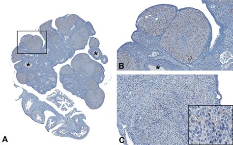 A Subgross Aperio Whole Image Slide Scan Showing Cd31 Download