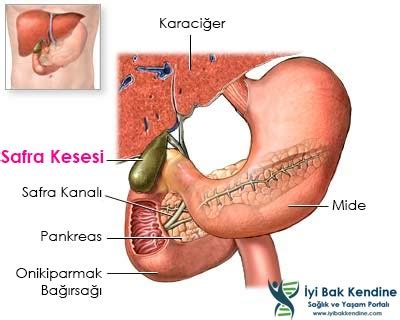 Safra Kesesi Ağrısı Nerede Olur Nasıl Anlaşılır Ne İyi Gelir