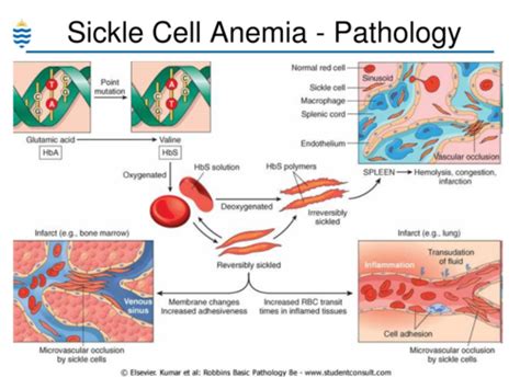 Hemolytic Anemia Flashcards Quizlet