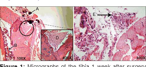 Figure 1 From Histologic Evaluation Of Chitosan As An Accelerator Of