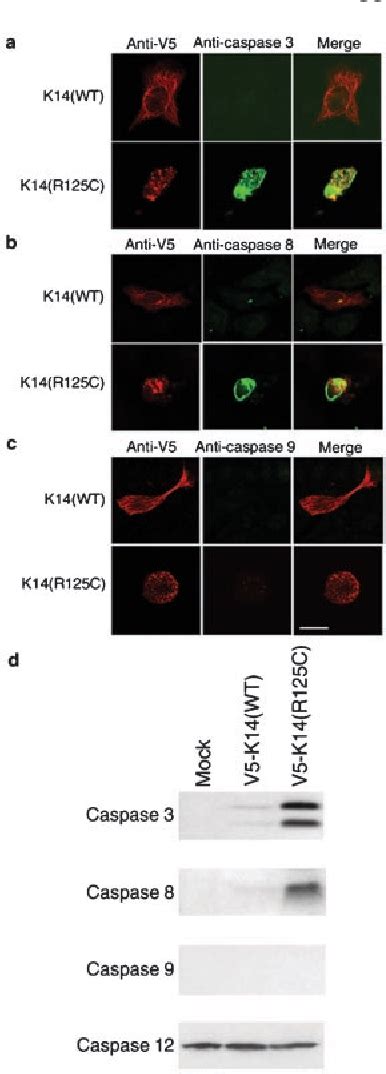 Figure 4 From An Autocrine Paracrine Loop Linking Keratin 14 Aggregates