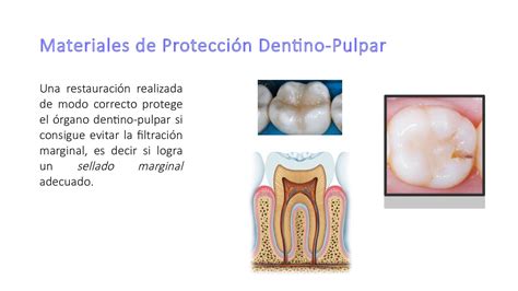 Calaméo Materiales Proteccion Dentino Pulpar Materiales Restaruracion