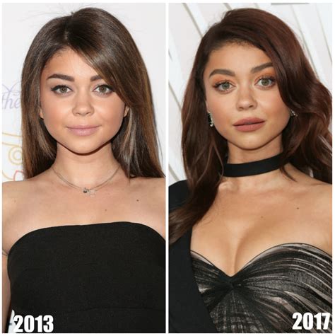 Did Sarah Hyland Get Plastic Surgery? — The 'Modern Family' Star Responds!