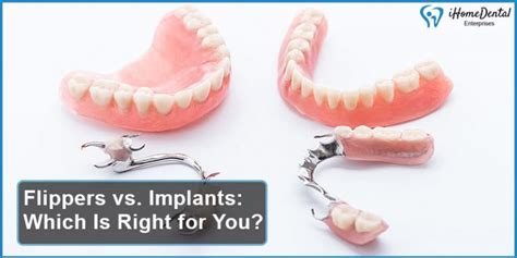 Flippers vs. Implants: Which Is Right for You? - iHome Dental