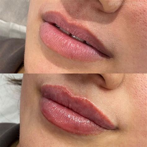 How To Maintain Healthy Luminous Lips Artofit