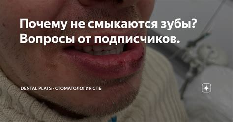 Почему не смыкаются зубы? Вопросы от подписчиков. | Дентал Платс | Дзен