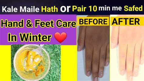 Hand And Feet Whitening In Winter Day Instant Hand Whitening