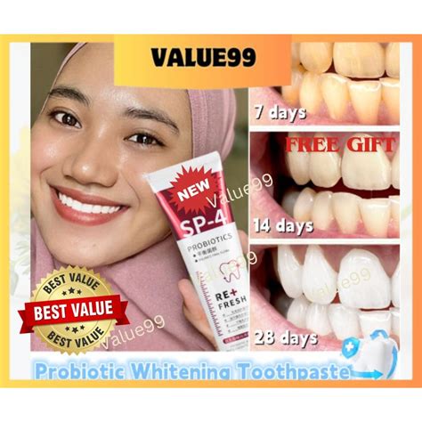 Ubat Gigi Sp Toothpaste Whitening Toothpaste Sp Teeth Whitening