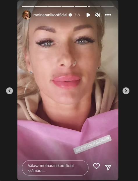 Teljesen Megv Ltoztatta K Lsej T A Porn Modell Moln R Anik K P Origo