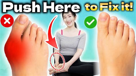 Instant Bunion Pain Relief Massage How To Fix Bunions Naturally At