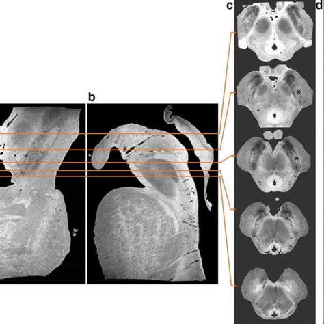 Comparison of NM-MRI (blue) and T2-weighted (red) substantia nigra... | Download Scientific Diagram