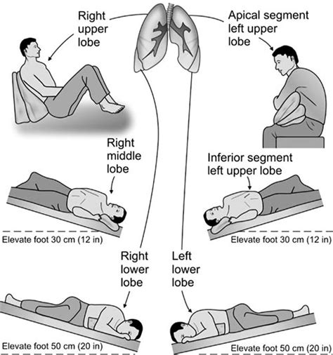 Postural Drainage Positions Pdf