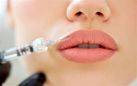 Lip Fillers And Injections Calgary The Injectionist And Aesthetics