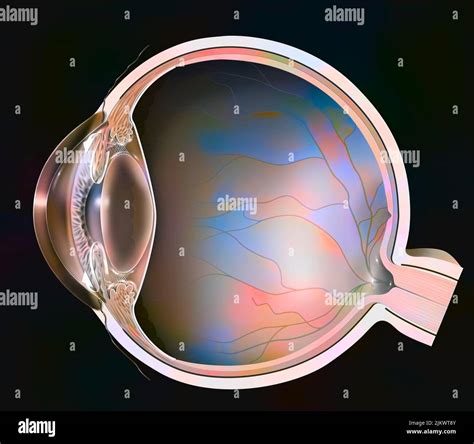 Chronic Non Congestive Glaucoma Hi Res Stock Photography And Images Alamy