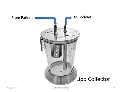 PPT - Water Jet Assisted Liposuction (BodyJet) and Fat Grafting ...
