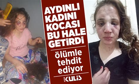 Kocasından şiddet Gören Aydınlı Genç Kadın Yetkililerden Yardım Bekliyor