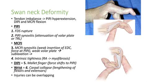 Extensor tendon injury | PPT