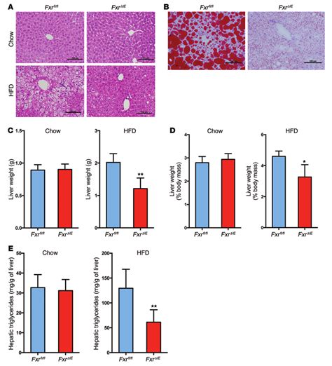 Intestine Specific Fxr Disruption Protects Against Hfd Induced Nafld