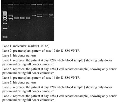 Full Donor Chimerism After Transplantation Download Scientific Diagram