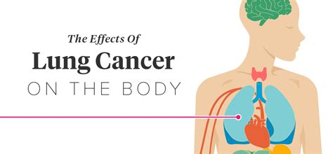 Effects of Lung Cancer on the Body