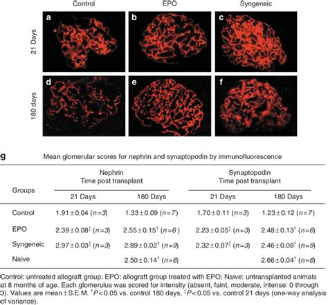 Glomerular Expression Of Nephrin And Synaptopodin In The Grafts Of