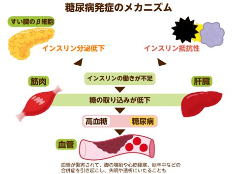 【医師監修】高齢者に多い糖尿病とは？適切な食事や認知症のリスクを解説｜みんなの介護