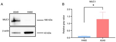 Improved Efficacy Of Cisplatin Delivery By Peanut Agglutininmodified