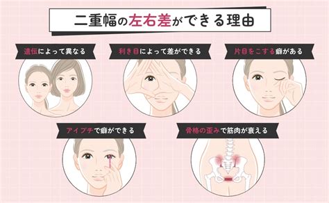 二重幅の左右差が気になる！原因や左右対称にする3つの方法