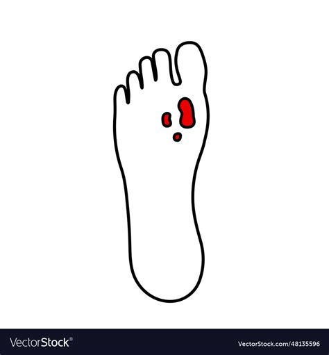 Diabetic foot ulcers Royalty Free Vector Image