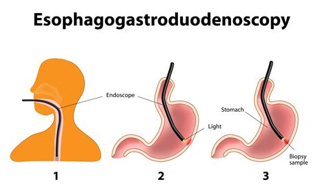 Gastrointestinal Endoscopy Cpm Advanced Surgical Specialists