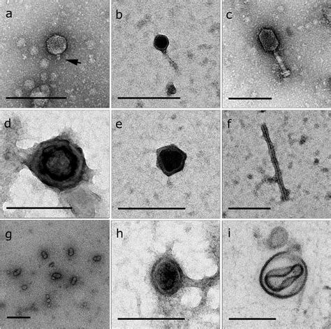 Transmission Electron Micrographs Depicting Representative Viral Like