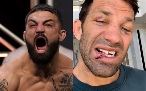 Luke Rockhold Mike Perry Shows Gaping Wound On His Knuckles From