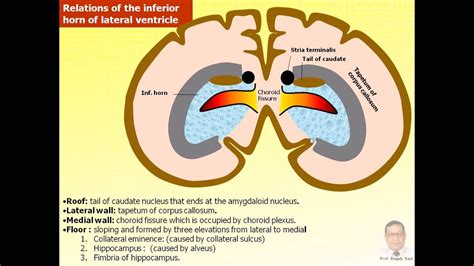 Magdy Said Anatomy Series Neuroanatomy 13 Lat Vent Tela Choroidea Septum Pellucidum Avi V1