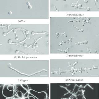 Comparison Between Fst And Fst Fis 1 Fis In Males And Females F