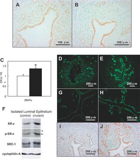 Coup Tfii Regulates The Expression Of Erα And Src 1 In The Uterine Download Scientific Diagram