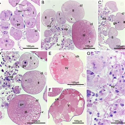 Histological Sections Of The R Sanguineus Ovary Of The Group Ii