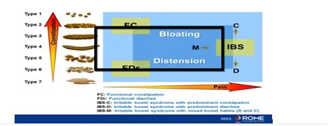 Rome Iv Aims To Improve Outcomes For Patients With Functional Gi