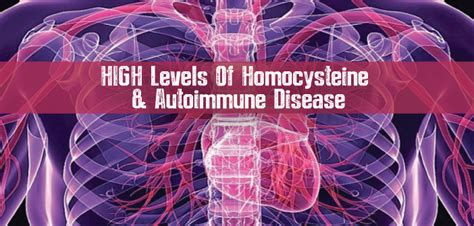 High Levels Of Homocysteine Linked To Autoimmune - Hashimoto's, Need to Know, Prevention, Thyroid