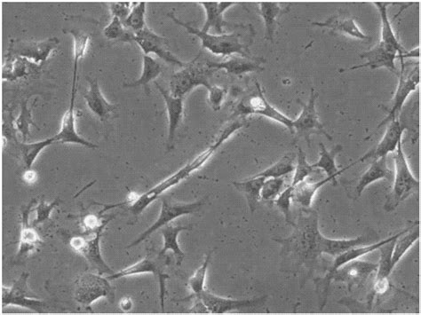 Separate Cultivation Method Of Myoblast Of Skeletal Muscle Of Naked